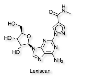 Lexiscan